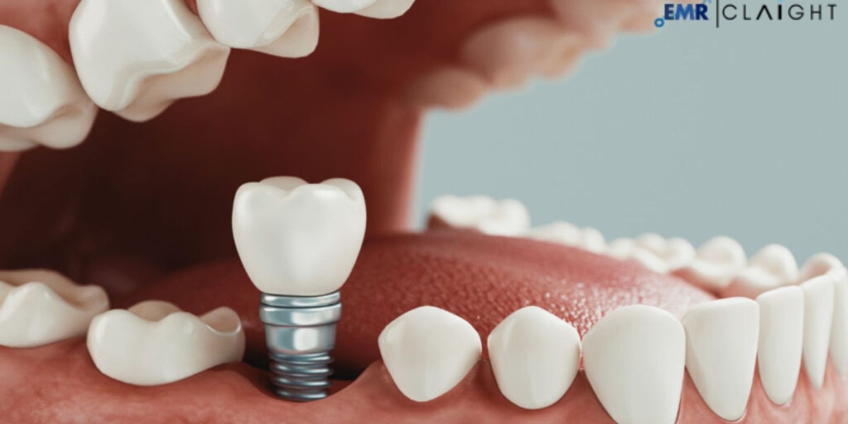 Global Dental Tourism Market Report, Share, Size & Growth | 2034